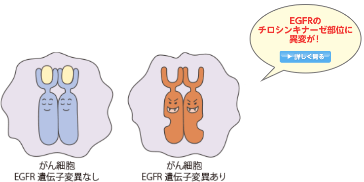 日本人に多いEGFR遺伝子変異