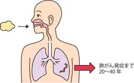 肺がん発症まで20～40年