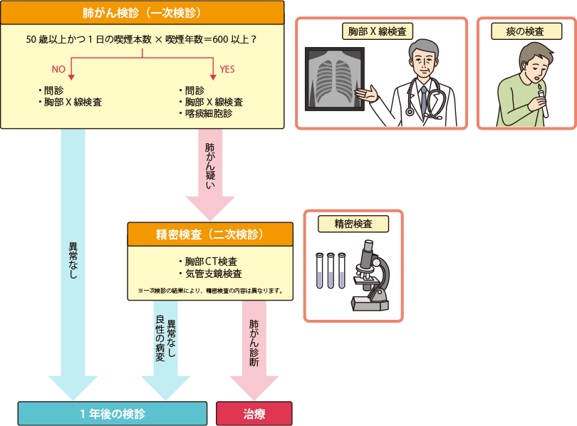 肺がん検診の流れ