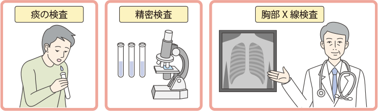肺がん検診と精密検査の方法