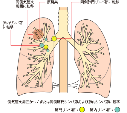 N1