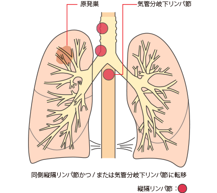 N2