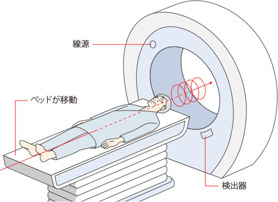 CTの撮り方