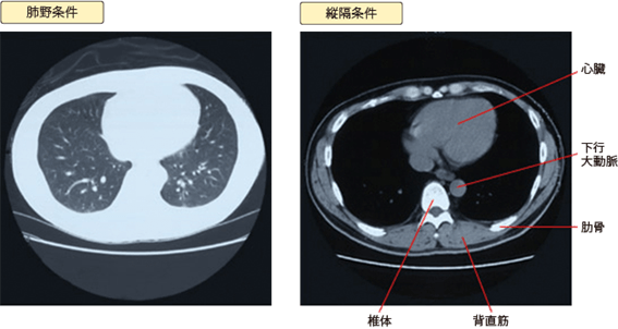 CT画像の種類