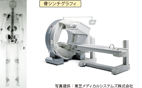 骨への転移を調べる骨シンチグラフィ