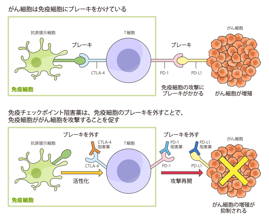 肺がん治療と CTLA-4阻害薬