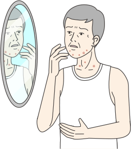 注射やお薬を飲んで副作用の症状を和らげます