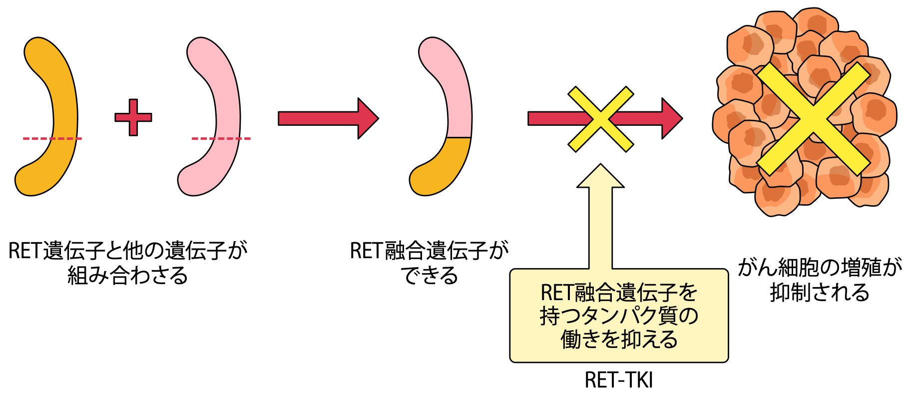 大細胞がんの発生しやすい場所