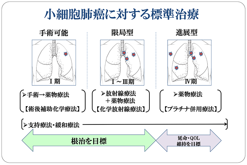 小細胞肺癌に対する標準治療