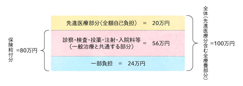 例:3割負担の患者さんが先進医療を受けて総医療費100万円(その内20万円が先進医療の費用)の場合